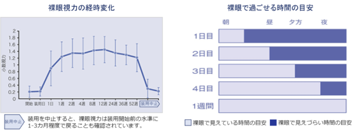 オルソケラトロジーとは